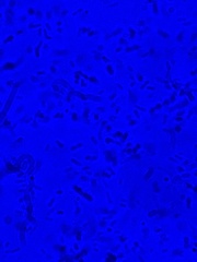 Bacillus cereus