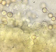 Pluteus septocystidiatus