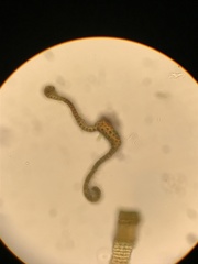 Racomitrium ryszardii