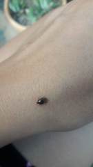 Histeridae
