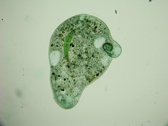Stentor coeruleus