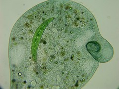 Stentor coeruleus