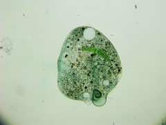 Stentor coeruleus
