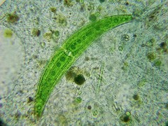 Stentor coeruleus