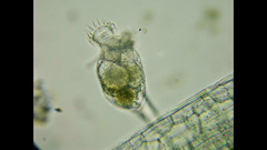 Philodina megalotrocha