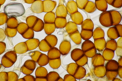 Puccinia asparagi