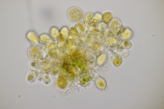 Naohidemyces vacciniorum