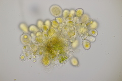 Naohidemyces vacciniorum