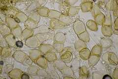 Puccinia chrysanthemi