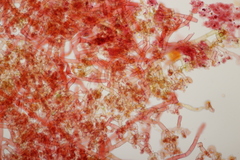Botryobasidium vagum