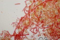 Botryobasidium vagum