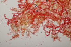 Botryobasidium vagum
