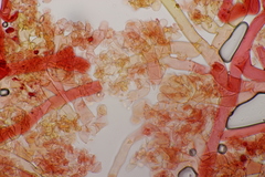 Botryobasidium vagum