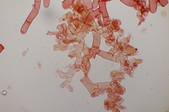 Botryobasidium vagum