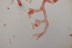 Botryobasidium vagum