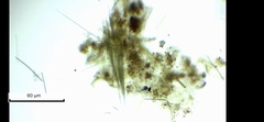 Aphanizomenon flosaquae