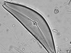 Cymbella