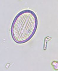 Cocconeis