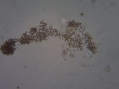 Microcystis