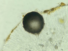 Muellerella lichenicola