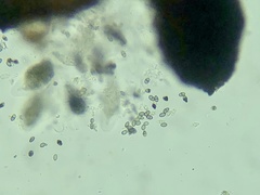 Muellerella lichenicola