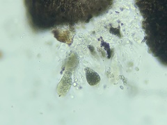 Muellerella lichenicola