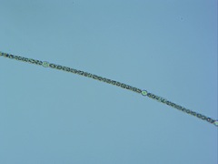 Dolichospermum planctonicum