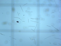 Dolichospermum planctonicum