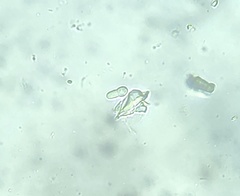 Arthonia patellulata