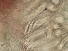 Bilimbia sabuletorum