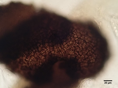 Bryostroma trichostomi