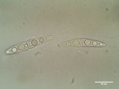 Bryostroma trichostomi