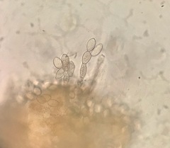 Monilinia fructicola