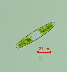Closterium navicula