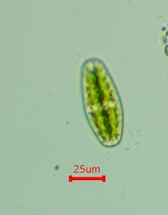 Netrium digitus