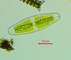 Netrium digitus