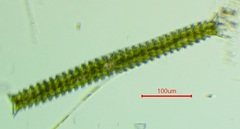 Triploceras verticillatum