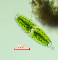 Netrium digitus