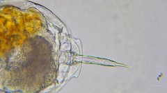 Lecane lamellata