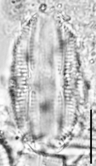 Amphora copulata
