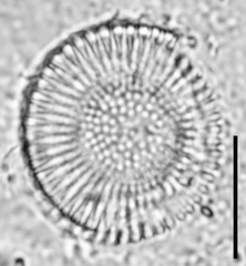 Cyclostephanos dubius