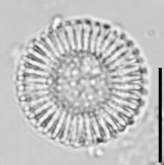 Cyclostephanos dubius