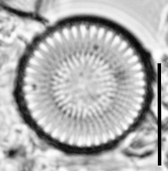 Cyclostephanos dubius