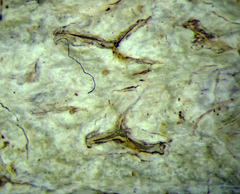 Acanthothecis