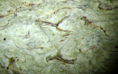 Acanthothecis