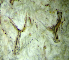 Acanthothecis
