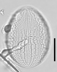 Cocconeis
