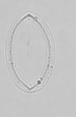 Cocconeis
