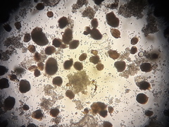 Saccharomyces cerevisiae