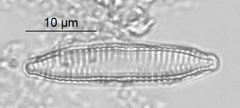 Fragilaria